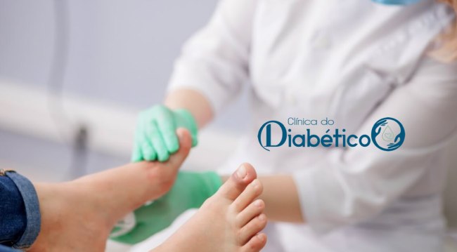 pe diabetico - tratamento de feridas e curativos especiais 2 mobile