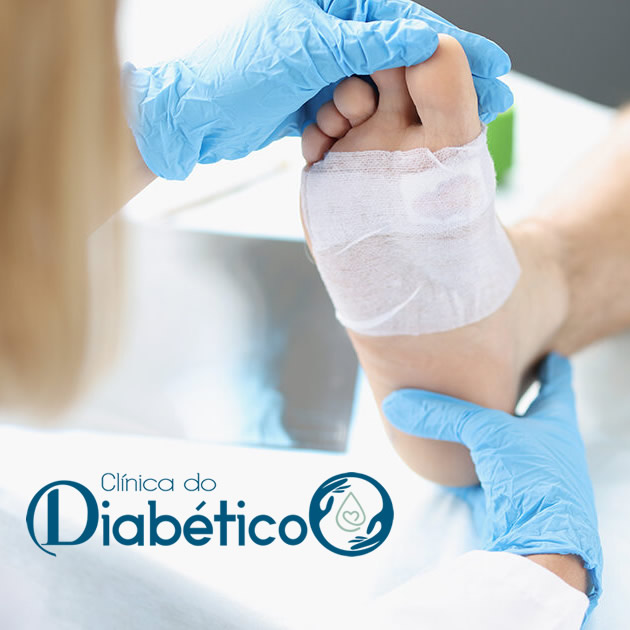 pe diabetico - tratamento de feridas e curativos especiais